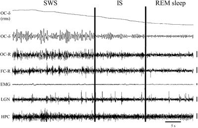 The Transition Between Slow-Wave Sleep and REM Sleep Constitutes an Independent Sleep Stage Organized by Cholinergic Mechanisms in the Rostrodorsal Pontine Tegmentum